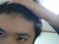 この生え際はきてますか 皆さんから見てハゲ始めてると感じま Yahoo 知恵袋