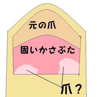 爪が剥がれてしまい 根元から爪らしいものが生えてきていますが 生え方が不自 Yahoo 知恵袋