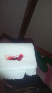 お尻から血が出ました 大便をして尻を吹いたらペーパーに血がついて Yahoo 知恵袋