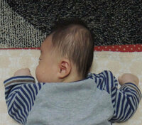 生後1ヶ月なら赤ちゃんの後頭部がデコボコしてます 昨日触ってみて気付いた Yahoo 知恵袋