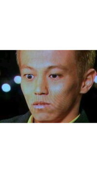 本田圭佑選手の目についてなんですが レーシック手術を受けてから片方 Yahoo 知恵袋