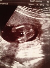 エコーでの胎児性別判断お願い致します 19週目のエコー画像で Yahoo 知恵袋