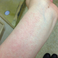 海鮮を食べて温泉に入り サウナに入りました 次の日には遊園地に行き日に当たり Yahoo 知恵袋