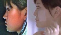 前田敦子さんの左側と全く同じ横顔なのですが やはり整形しないと右側 Yahoo 知恵袋