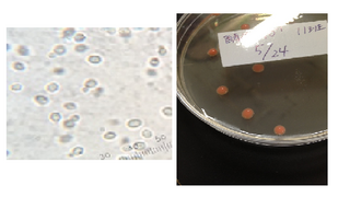 アルコール発酵を行わない赤色酵母は存在しますか 微生物の実験で赤色酵母だと思 Yahoo 知恵袋