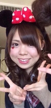 ミランダ カーのような可愛いえくぼが欲しいのですが えくぼは Yahoo 知恵袋