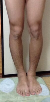 ひざの裏がぽっこり盛り上がってるのですが 筋肉のようです なんでこんなと Yahoo 知恵袋