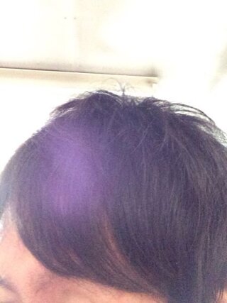 こめかみあたりの前髪が割れてしまうのですが仕方がないのでしょうか Yahoo 知恵袋