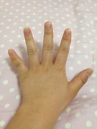 わたしの手の指がとても太いです 特に小指が太いです どうすれば細くなり Yahoo 知恵袋