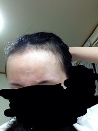 おでこがめちゃくちゃ広くて前髪をどうするかいつも悩んでます おでこを Yahoo 知恵袋