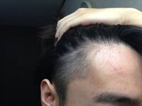 前髪の生え際の形で こういう感じで一直線になってるのはおかしいです Yahoo 知恵袋