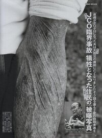この写真は東海村臨界事故のものですか 詳細を教えてください詳細を教えて Yahoo 知恵袋