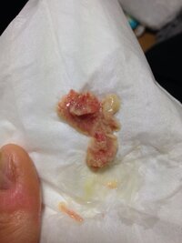 これは痰ですか 写真あり昨日から風邪で寝込んでいました 今朝 喉が痰が絡ん Yahoo 知恵袋