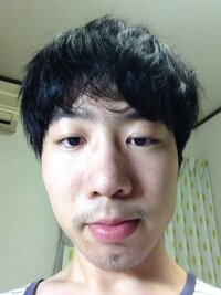 眼科にお詳しい方 または目を殴られたり打撲したことある方お願い Yahoo 知恵袋