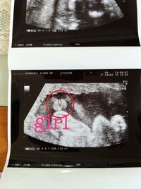 現在妊娠7ヶ月の妊婦です 今日検診で赤ちゃんのお股が見えたのですが 先生から Yahoo 知恵袋