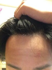 17歳男子です おでこの広さがコンプレックスで 前髪伸ばすの Yahoo 知恵袋