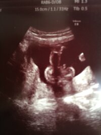 妊娠18w 5ヶ月 の妊婦です 今日の検診で性別ききたい と尋ねられ股のエコ Yahoo 知恵袋