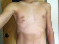 高校一年の男子です 僕は自分のことが嫌いです その理由は男なのに胸があること Yahoo 知恵袋