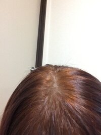 大至急 助けてください 昨日自分でブリーチと毛染めをしたら Yahoo 知恵袋