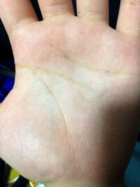 私の手相は三つの線 感情線 頭脳線 生命線 が鎖状になっています Yahoo 知恵袋