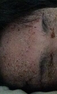 皮膚病に詳しい方に質問します彼氏が皮膚の痒みと激痛で悩んでいます もともとア Yahoo 知恵袋