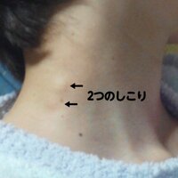 いろいろ 首の付け根 こりこり 253286-首の付け根 こりこり