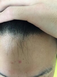 これは生え際薄いのですか 髪をかきあげるとこのように少し頭皮見える Yahoo 知恵袋