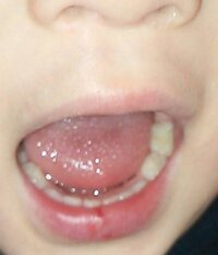 保育園のけがに関する質問です 先日嫁が単身赴任の私に電話をかけてき Yahoo 知恵袋