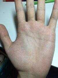 手の甲にシワが多いのがコンプレックスです 友達はみんな綺麗な手な Yahoo 知恵袋