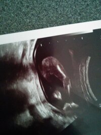 妊娠16週エコー写真について わかる方お願いします 先生からは子宮 Yahoo 知恵袋