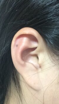 ピアスを開けたいところに ほくろがあるんですが開けても大丈夫なんですかね ち Yahoo 知恵袋