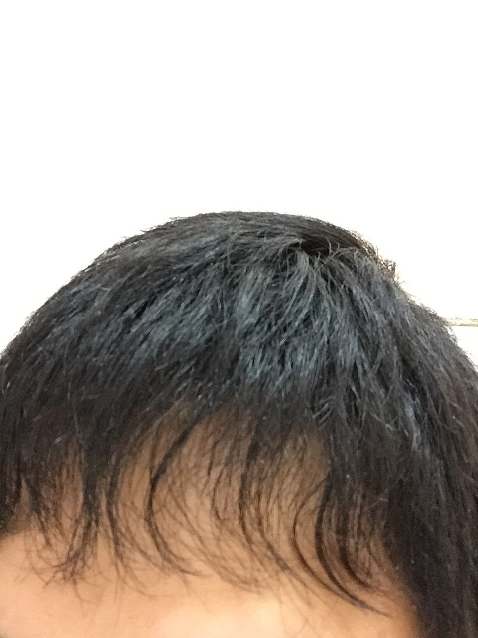 前髪 薄い 男 画像 前髪 薄い 男 画像 Muryoshare