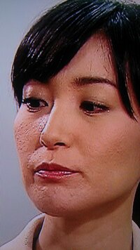 大江麻理子の肌荒れ くま しわ 充血 ストレスがたまっているのか Yahoo 知恵袋