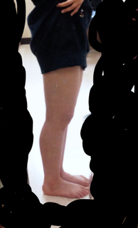 太ももを10センチ細くしたいのですが 10センチ位痩せるにはどのようなことが Yahoo 知恵袋