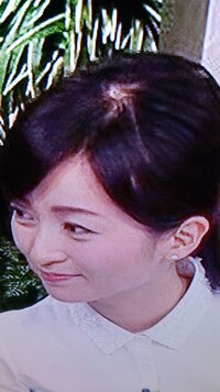 スザンヌはハゲましたか ハゲてますね 戸田恵梨香 益若つばさ 中川翔 Yahoo 知恵袋