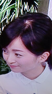 大江麻理子アナ（テレビ東京）のハゲ、薄毛は、やはり略奪婚による苦労なんでしょうか？ 