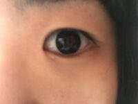 この目の蒙古襞は強いですよね 強すぎます最強だと思います目頭 Yahoo 知恵袋
