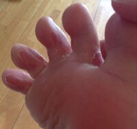 写真有り 足の指と指の間の皮がむけます中学生のバスケ部です バス Yahoo 知恵袋