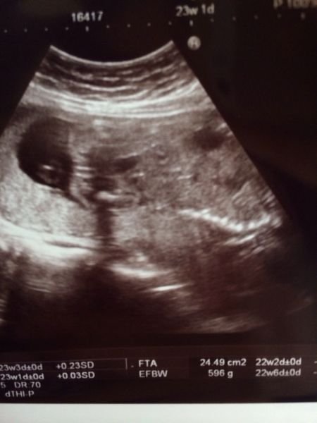 3本線 男の子 に関するq A Yahoo 知恵袋