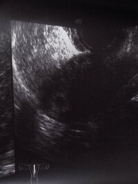 エコー写真について いつもお世話になっております 本日5w1d胎嚢確認できた Yahoo 知恵袋