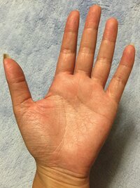 手相 手相について 私の手のひらは小さな頃からシワだらけで おばあちゃんの Yahoo 知恵袋