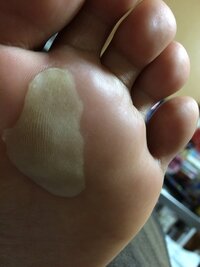 足の裏の皮が急に白くブヨブヨになってしまったのですがこれは水虫なん Yahoo 知恵袋