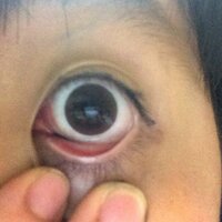 アイラインをすると必ず液が目に入ってしまいます なぜ入るのでしょう Yahoo 知恵袋