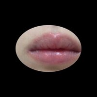 唇のふちがかゆいです 2日ほど前から唇のふちが痒くかいてしまいます それが Yahoo 知恵袋