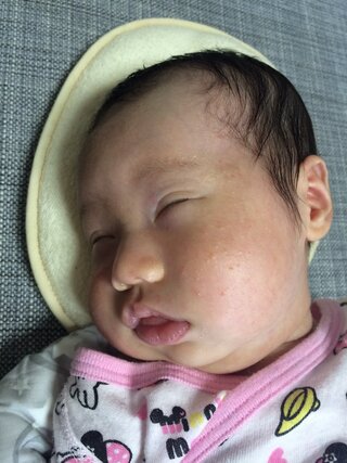 新生児の目について生後もうすぐ1ヶ月になる娘がおります 画像のよう Yahoo 知恵袋 新生児の目について生後もうすぐ1ヶ月になる娘がおります 画像のよう Yahoo 知恵袋