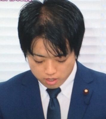 武藤貴也 36 の髪ヤバくないですか 未公開株未成年買春色と金に激しく Yahoo 知恵袋