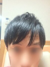 中学生３年生男で薄毛で困っています 気になりだしたのが 今年の４月くらいで Yahoo 知恵袋