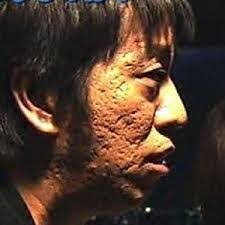 吉田 肌 ブラマヨ