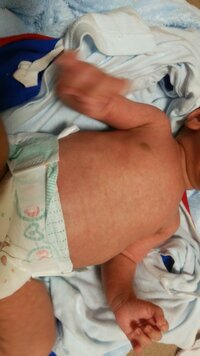 生後1ヶ月の男の子のママをしています 赤ちゃんの肌が赤黒いです 上の子は1ヶ Yahoo 知恵袋
