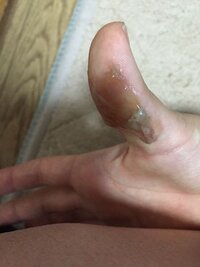 汚い画像ですみません 膣から出てきたのですが これはオリモノ Yahoo 知恵袋